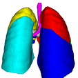 2.png 3D Model of Lungs, Vessels and Airways - generated from real patient