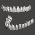 Model-A.png Aesthetic Tooth Libraries