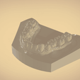 Screenshot_21.png STL file Digital Orthodontic Study Models with Virtual Bases・3D printing idea to download