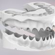 9.jpg 3D Dental Jaws Replica with Detachable Teeth