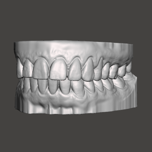 DENTAL MODEL 3D model