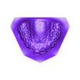 ABO 2013 Base Upper jaw.stl Maxilla and Mandible orthodontic study models with an ABO 2013 base.