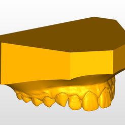 Maxilla.jpg Maxilla and Mandible orthodontic study models with a Parallel base.