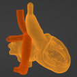 24.png 3D Model of Heart after Fontan Procedure