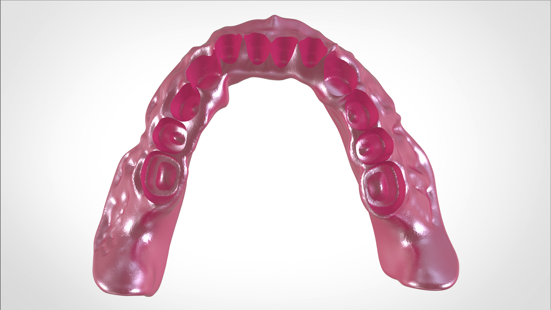 Screenshot_9.png Download OBJ file Digital Full Dentures for Gluedin Teeth with Manual Reduction • 3D printable design, LabMagic3DCAD