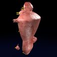 0020.jpg Fibroid Uterus Human female 3D