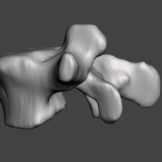 Screenshot_3.png menschlicher Wirbel L5