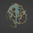 uv20.png 3D Model of Brain Arteriovenous Malformation