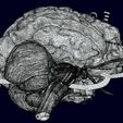 screenshot160.jpg Central nervous system cortex limbic basal ganglia stem cerebel 3D model