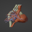 3.png 3D Model of Human Heart with Tetrology of Fallot (TOF) - generated from real patient
