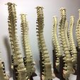 IMG_5213.jpg SPINE WITHOUT SUPPORTS PROFESSIONAL MEDICINE