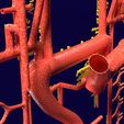 PS0082.jpg Human arterial system schematic 3D