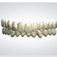 27.png Digital Full Dentures with Combined Glue-in Teeth Arch
