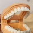 5579f952-8839-4d0c-a870-f6903c6041d0.jpg Mouth Chip Clip from 3D Scan of Teeth