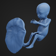 18weeks_2.png 18 weeks fetus