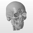 cranio-1.jpg A cranial plate to replace a skull defect (an example of a real operation 2)