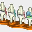 4.jpg total knee replacement model ( TKR ), EDUCATING / TEACHING MODEL