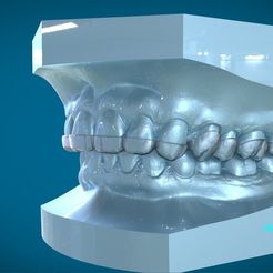 1.jpg STL file Digital Dental Dayguard Splint・3D printing idea to download, LabMagic3D
