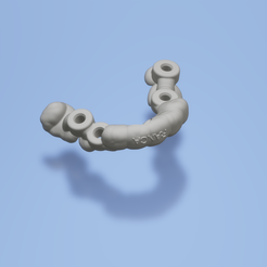Surgical.png Download STL file Surgical guide dental implant • 3D printer design, lablexter