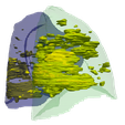 8.png 3D Model of Lungs Infected with Covid19