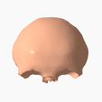 1.png FRONTAL BONE SEGMENTED 3D MODEL