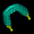 UpperJaw-articulator-2.png Modèle dentaire avec 10 facettes et articulateur