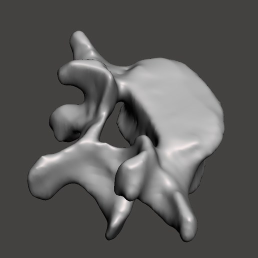 Screenshot_4.png menschlicher Wirbel L5