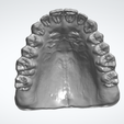 UP.png Full Arch Dental Study Model with Roots and Alveolar Bone (STL)
