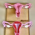 IMG_2213.jpeg 子宫解剖模型