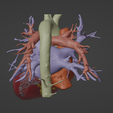 4.png 3D Model of Heart (from real patient)