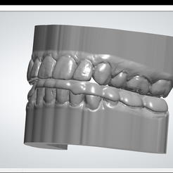 imagen_2022-08-14_151304134.png Free STL file Models with programmed occlusal plate・3D print design to download, leninov12