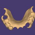 Clipboard-2025-05-07-23-27-33.jpg DIGITAL FLEXIBLE PARTIAL DENTURE (upper base + artificial teeth)