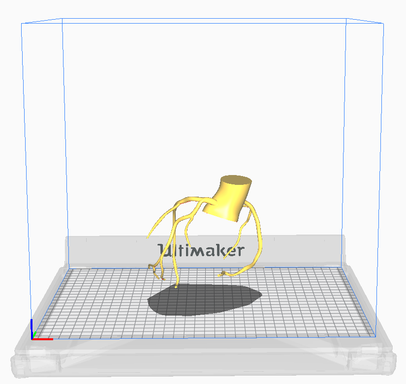 Download OBJ file 3d model of coronary arteries • Design to 3D print ...