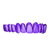1530538825_20190103_1136_RAMI ME41911F2D588D4129A0DE51B33E79DC30 0.stl STL file Digital Full Dentures for Gluedin Teeth with Manual Reduction・3D printable design to download