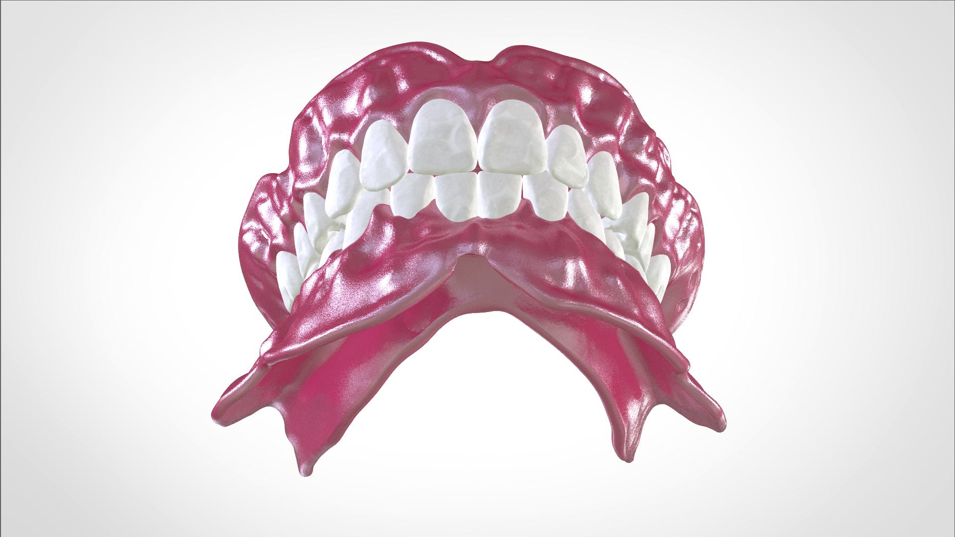 Screenshot_19.png Download OBJ file Digital Full Dentures for Gluedin Teeth with Manual Reduction • 3D printable design, LabMagic3DCAD