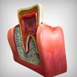 Front_View.jpg Tooth cutaway