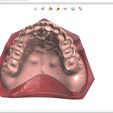 9.jpg STL file Digital Full Dentures for Gluedin Teeth with Manual Reduction・3D printable design to download