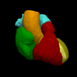 5.png 3D Heart Model - generated from real patient