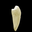 14.png First lower left first premolar #34