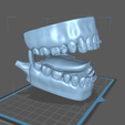 M3.png Mouth with Braces