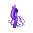 aorta and coronary artery.obj 三维冠状动脉和心脏主动脉