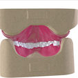 3.png Digital Full Dentures with Combined Glue-in Teeth Arch