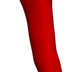1.png Modèle d'anévrisme de l'aorte abdominale d'un patient réel
