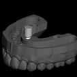 Captura de Pantalla 2020-04-02 a la(s) 19.24.02.png Dental Model with detachable teeth