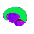 1.png Subdivision of cranial dura mater SEGMENTED IN 3 PARTS