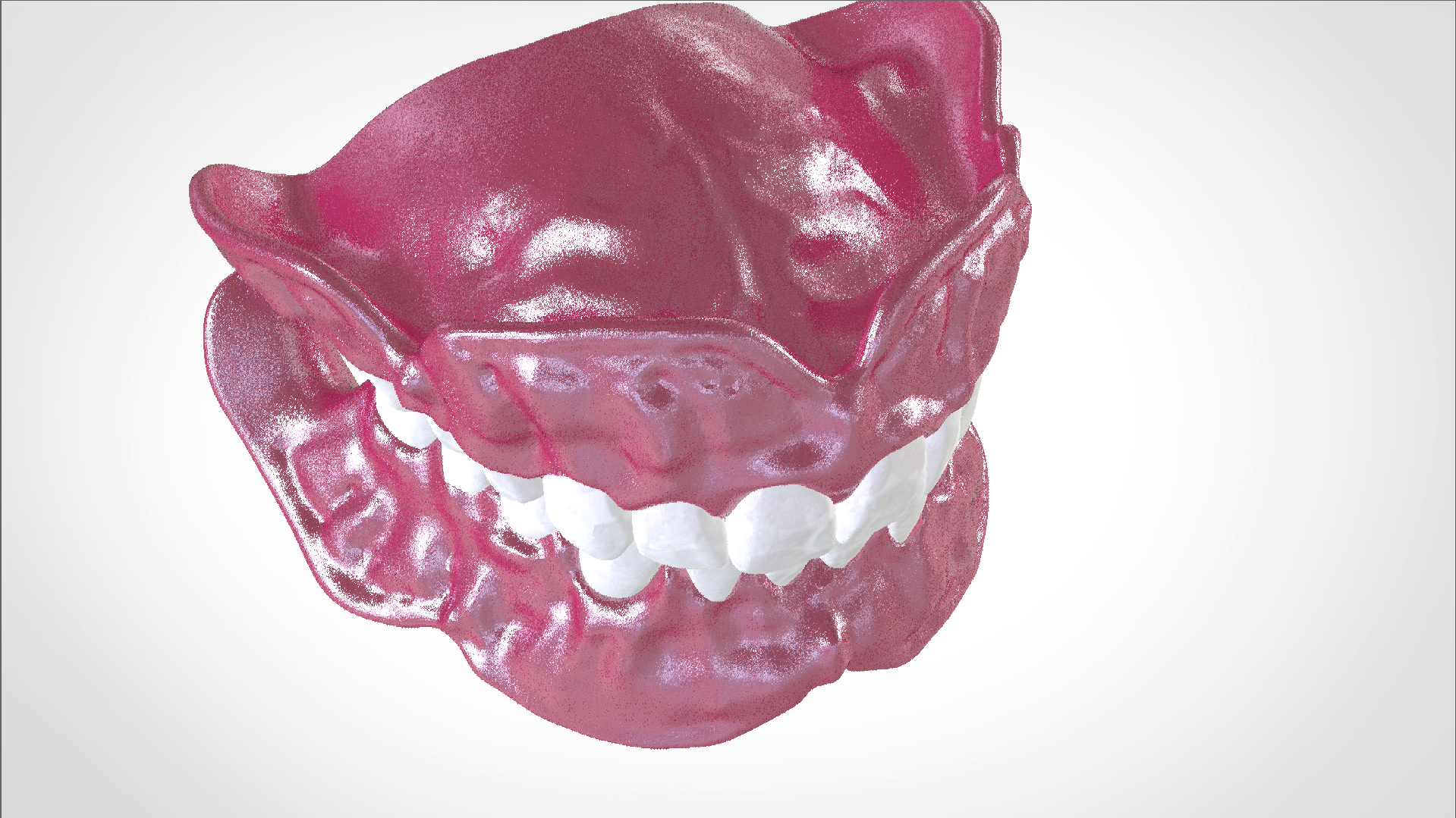 Screenshot_20.png Download OBJ file Digital Full Dentures for Gluedin Teeth with Manual Reduction • 3D printable design, LabMagic3DCAD