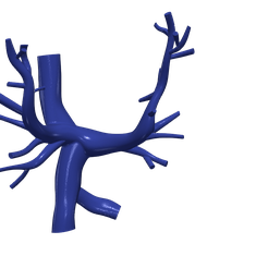 1.png 3D Model of Pulmonary Arteries (Fontan Procedure)