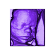 ROBERTA AMIGA MARLETE_1.stl real baby fetus ultrassound
