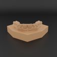 untitledj.jpg Dental Orthodontic Study Model with  Bases