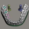 meshmixer_3NSTeF74jP.png Dental Models for Practice